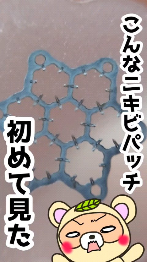 ACマグネシウムパッチ　ミニ/スノーツープラス/にきびパッチの動画クチコミ3つ目