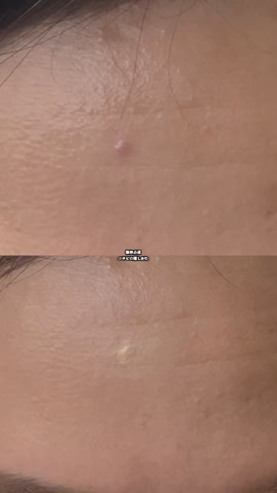 これでニキビも怖くない！？
ウォータープルーフのコンシーラーを使ったら、しっかりカバーしてくれて良かったよ！！

#PR #ニキビ #コンシーラー