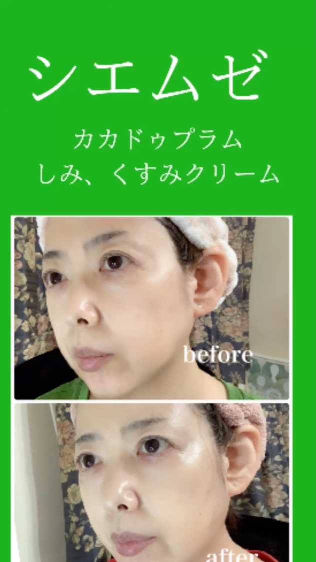 カカドゥプラム シミくすみクリーム/シエムゼ/フェイスクリームを使ったクチコミ（1枚目）