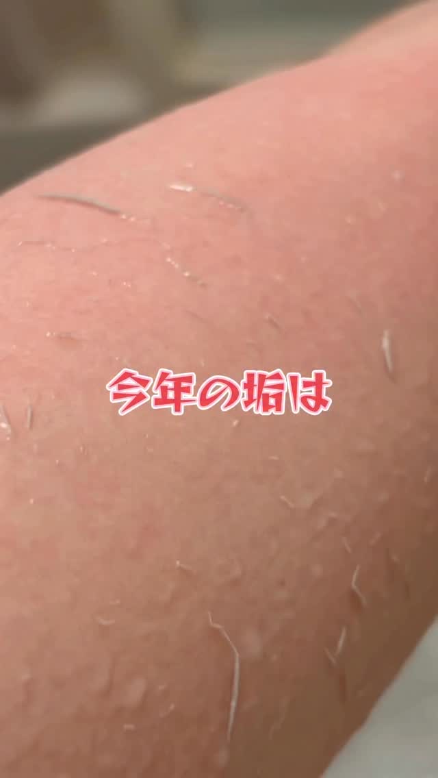 あかとりピーリングジェル/あかすり屋/ピーリングを使ったクチコミ（1枚目）