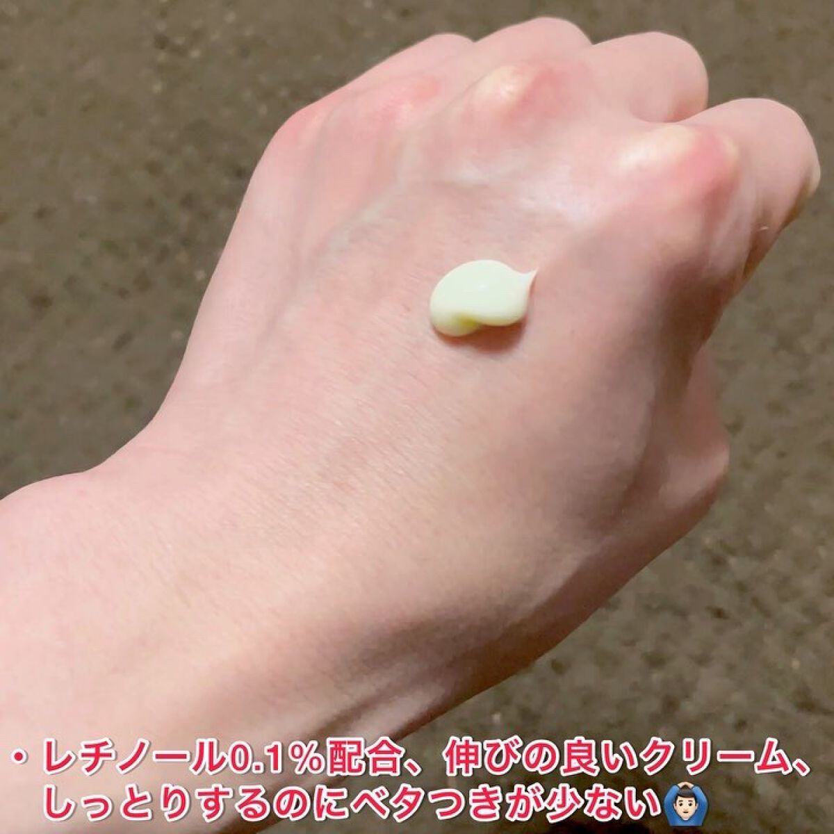 レチノール0.1％クリーム/Frankly/フェイスクリームを使ったクチコミ（2枚目）