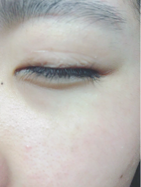 ルドゥーブル/ルドゥーブル/二重まぶた用アイテムを使ったクチコミ(3枚目)