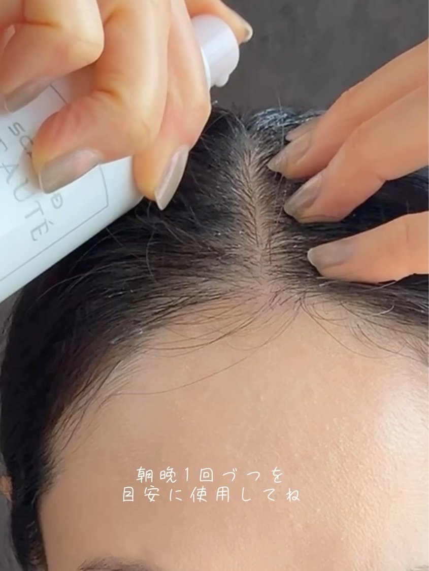 スカルプD ボーテ　薬用スカルプセラム/アンファー(スカルプD)/頭皮ローションを使ったクチコミ（3枚目）