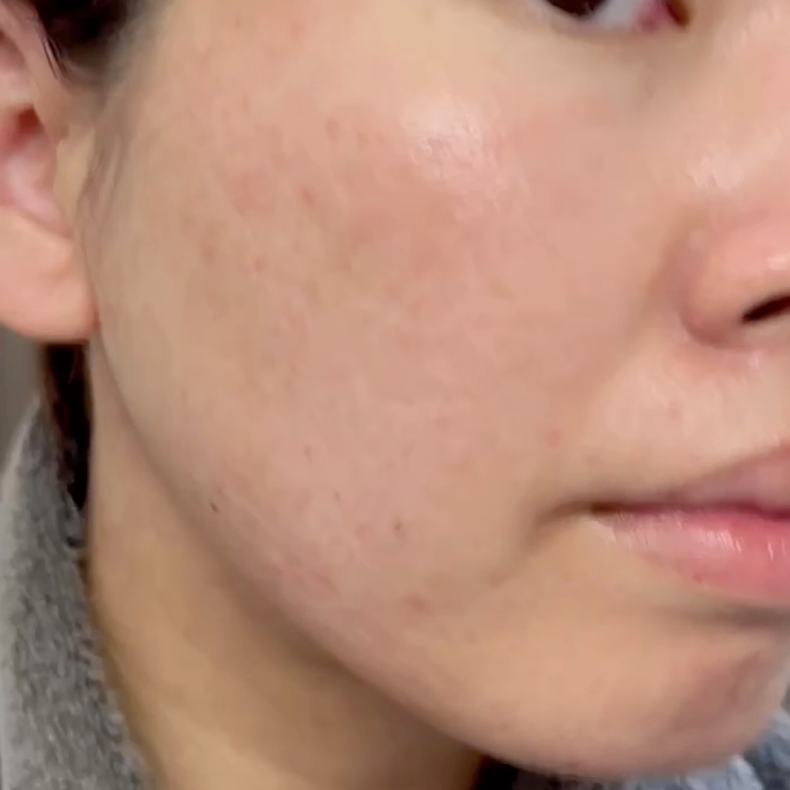 フィルベビー ベビークリーム/ピジョン/ボディクリームの動画クチコミ1つ目