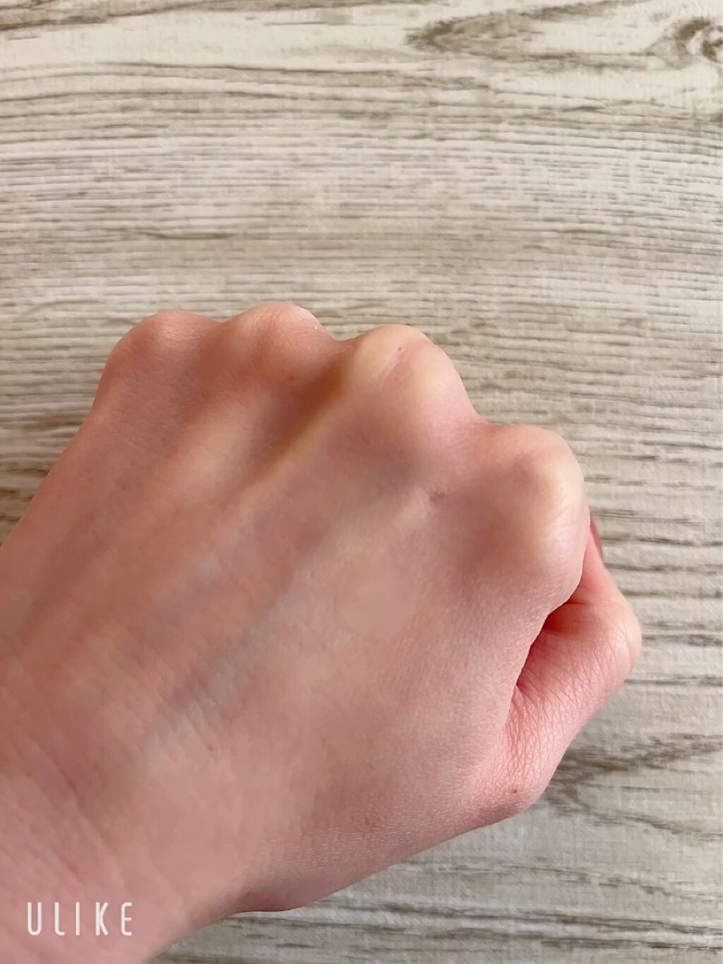  A-zero Shot スキンドレッシングパッチ/MEDIHEAL/シートマスク・パックの動画クチコミ4つ目