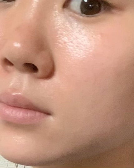 ドクダミ 70 インテンスカーミングクリーム/Anua/フェイスクリームを使ったクチコミ(6枚目)