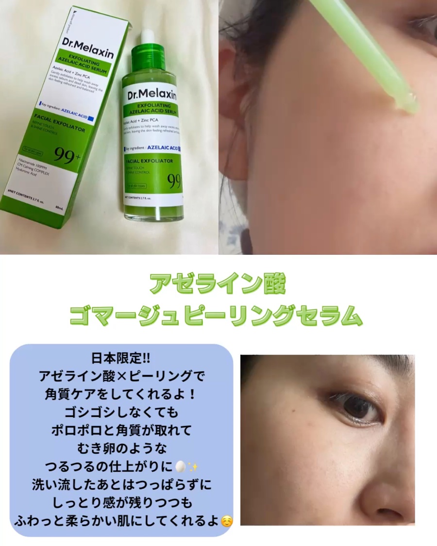 アゼライン酸ゴマージュピーリングセラム/Dr.Melaxin/美容液を使ったクチコミ（1枚目）