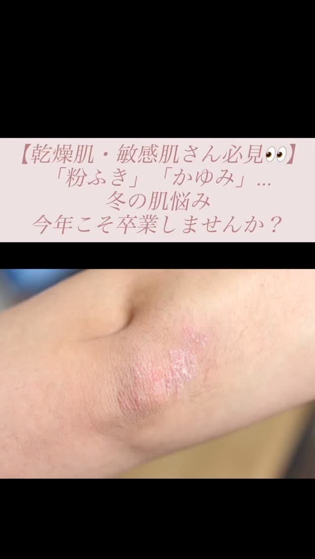 スキンバリア モイスチャライジングクリーム/COSRX/ボディクリームの動画クチコミ4つ目