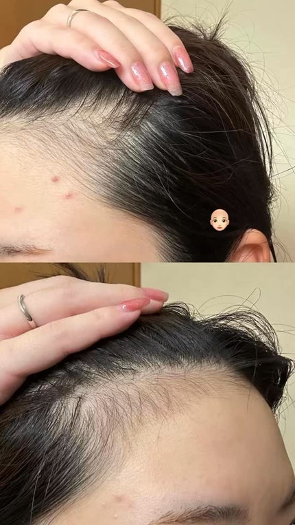 ボリューマイジング&スーディングヘアトニック/SallyZen/頭皮ローションの人気ショート動画