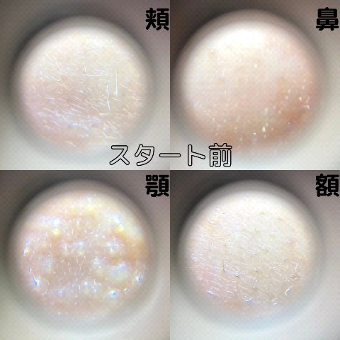 VITALIFT A forte/Dr.Different/フェイスクリームを使ったクチコミ（1枚目）