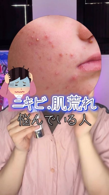 ハーブインフューズドカーミングクリーム/CHICHO/フェイスクリームの動画クチコミ1つ目