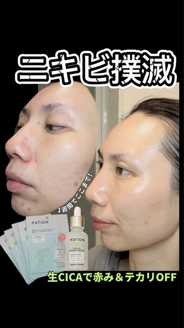 ノスカナイン T セラムマスク S/FATION/シートマスク・パックを使ったクチコミ（1枚目）