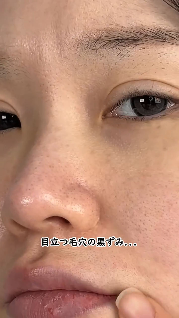 黒米ピールショットゴマージュアンプル/Dr.Melaxin/美容液の動画クチコミ2つ目