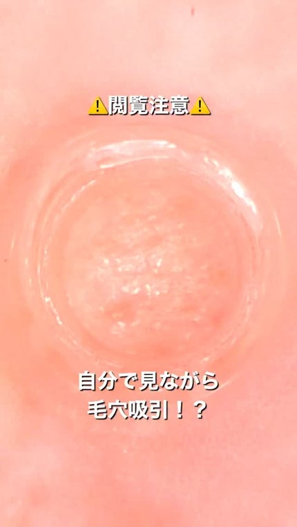 アレティ ポアスコープ/Areti./美顔器・マッサージを使ったクチコミ(1枚目)