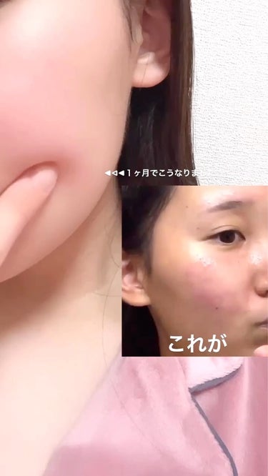 薬用ふわふわな泡洗顔/メンソレータム アクネス/泡洗顔を使ったクチコミ（1枚目）