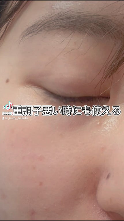 メザイク イージークリア 接着クリアタイプ/メザイク/二重まぶた用アイテムを使ったクチコミ(1枚目)