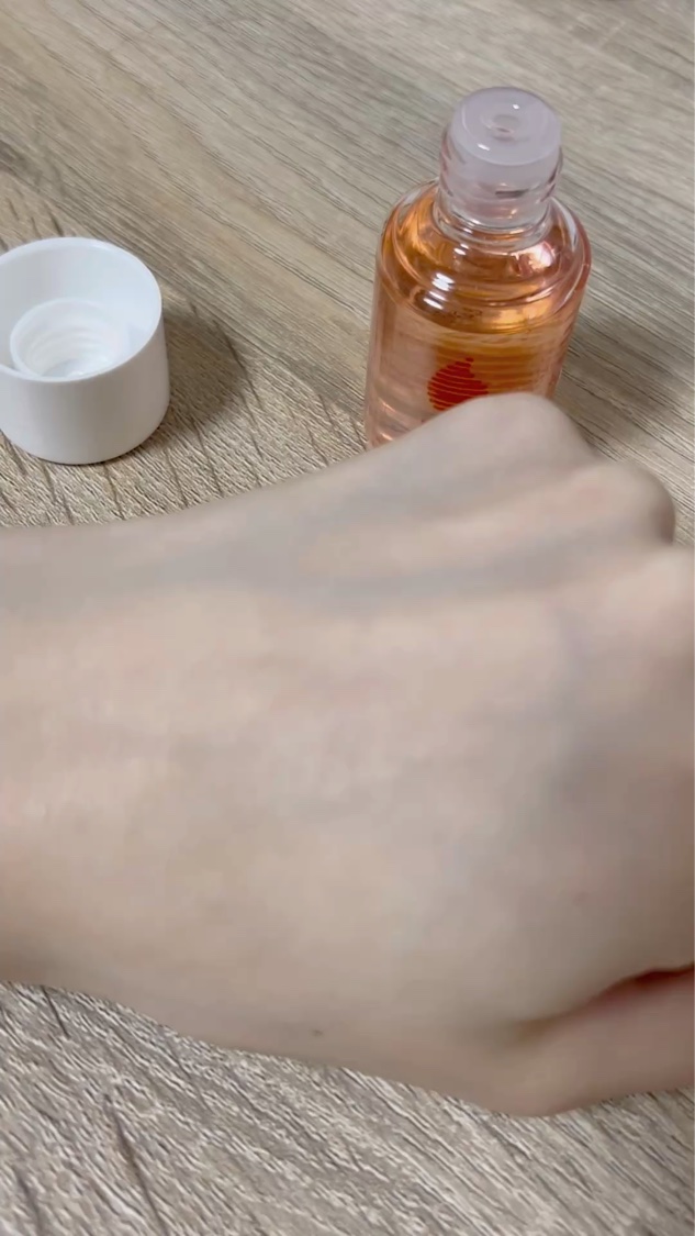 バイオイル/バイオイル/フェイスオイルを使ったクチコミ（2枚目）