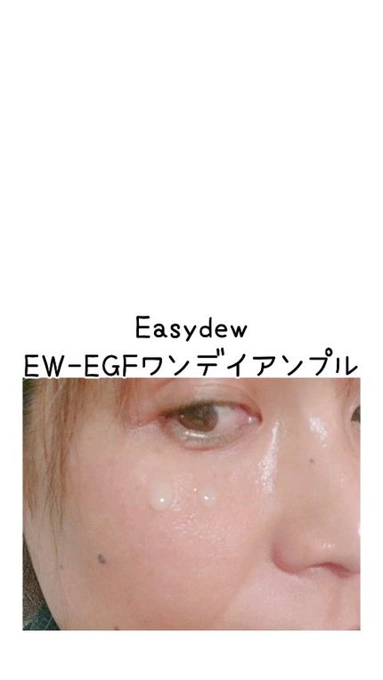 DW-EGFワンデイズアンプル/Easydew/美容液の人気ショート動画