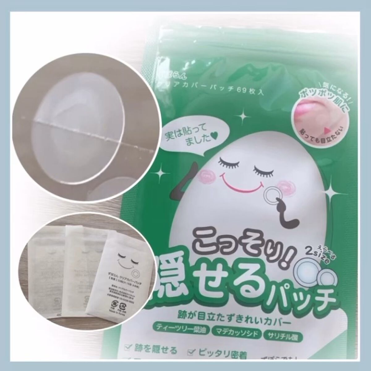 ずぼらん クリアカバーパッチのクチコミ「あまり目立ちませんが完璧に隠れる訳ではないです。
吹き出物を触ってしまう方におすすめしたいです.....」（1枚目）