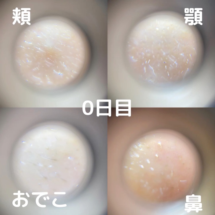 シカレチA エッセンス0.7/VT/美容液を使ったクチコミ（2枚目）