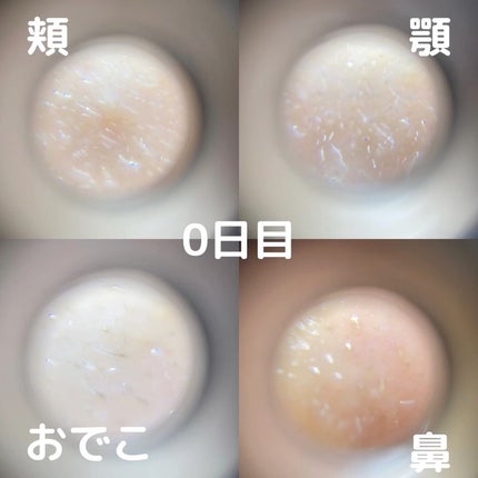 シカレチA エッセンス0.3/VT/美容液を使ったクチコミ(2枚目)