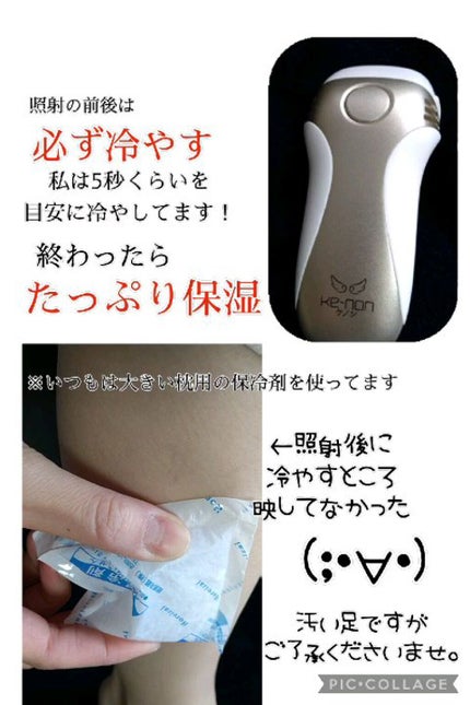 光美容器KE-NON(ケノン)|エムテックの効果に関する口コミ 光美容器KE-NON(ケノン)|エムテックの効果に関する口コミ