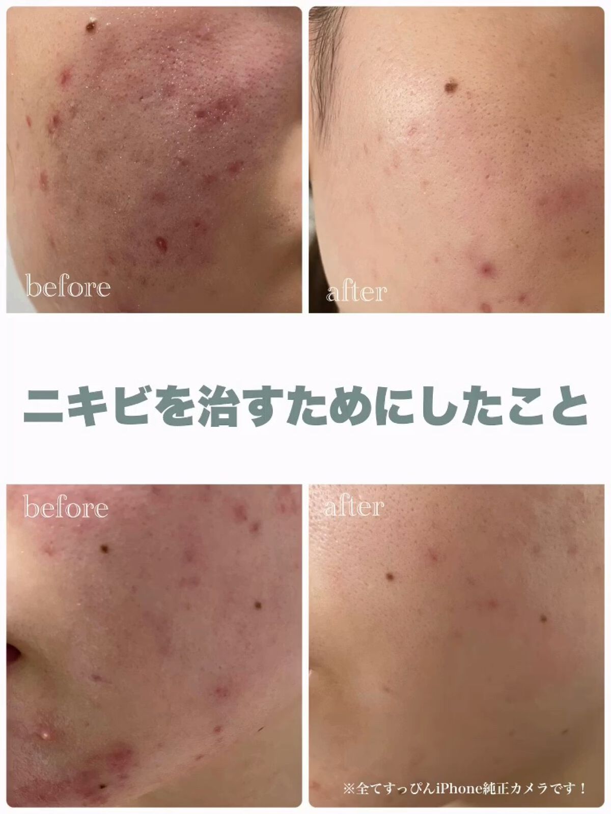 化粧水　敏感肌用　さっぱりタイプ/無印良品/化粧水の動画クチコミ5つ目