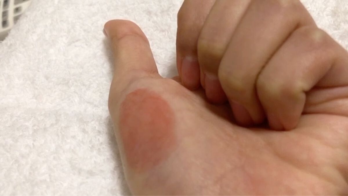 を使ったクチコミ（2枚目）