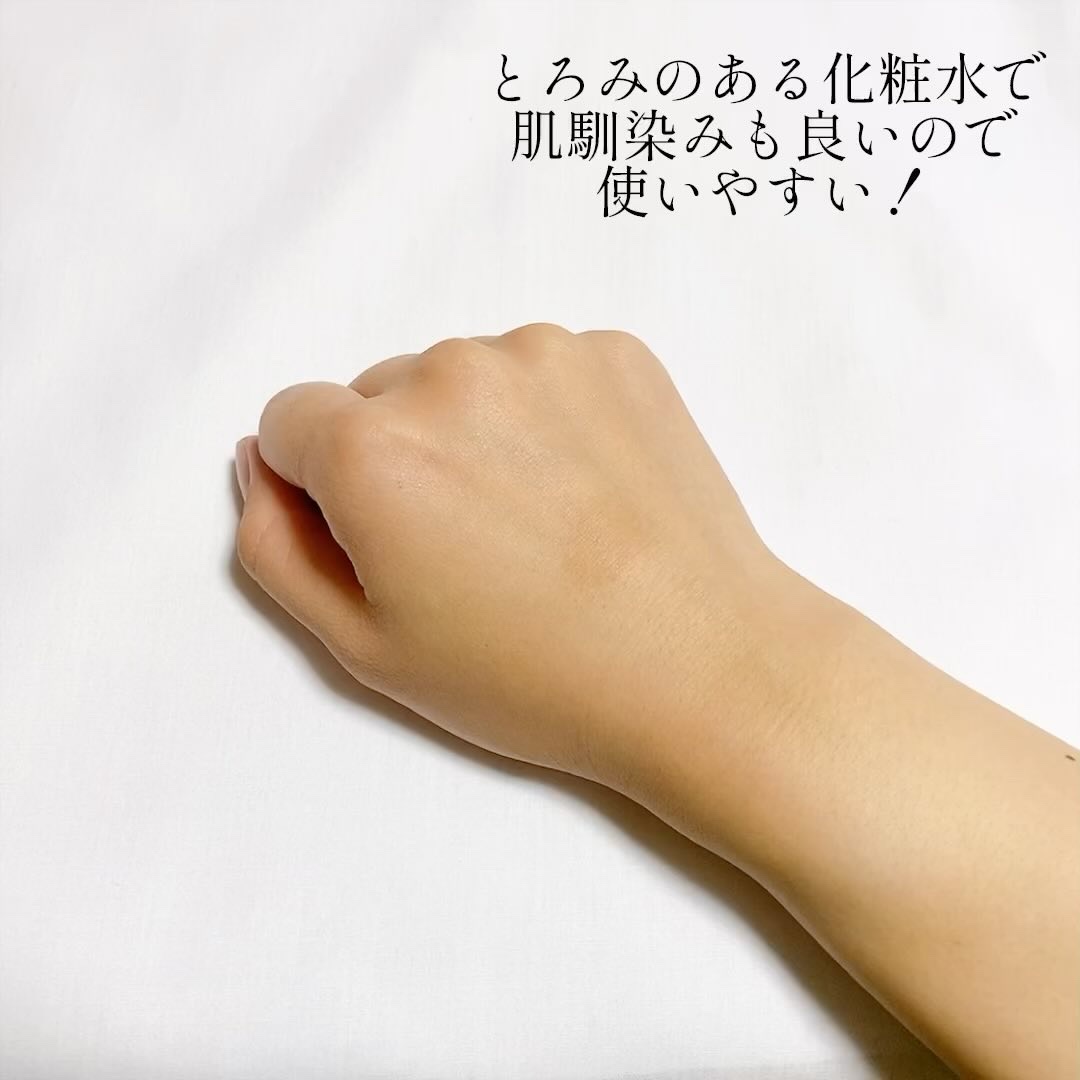 アクアヒアルロニックエッセンス/ロベクチン/化粧水を使ったクチコミ（3枚目）