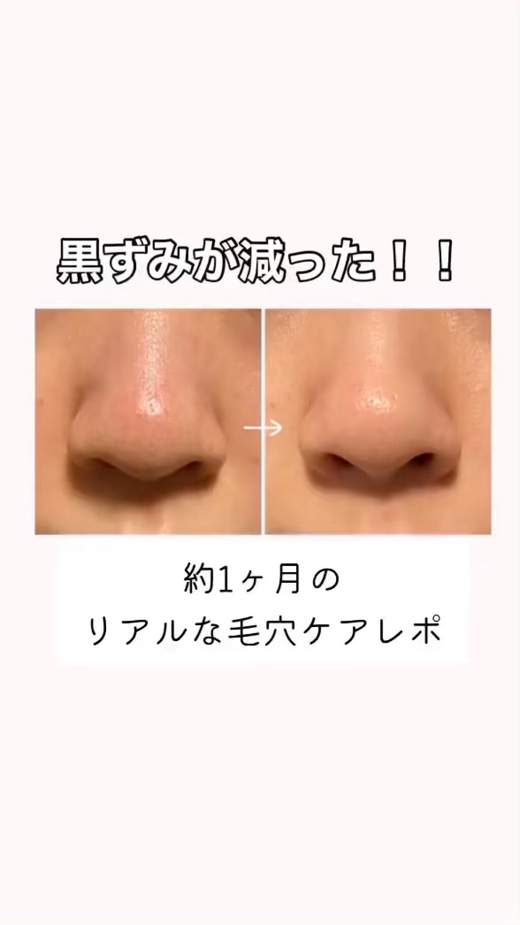 ルミエール ヴァイタルC/FEMMUE/ブースター・導入液を使ったクチコミ（1枚目）