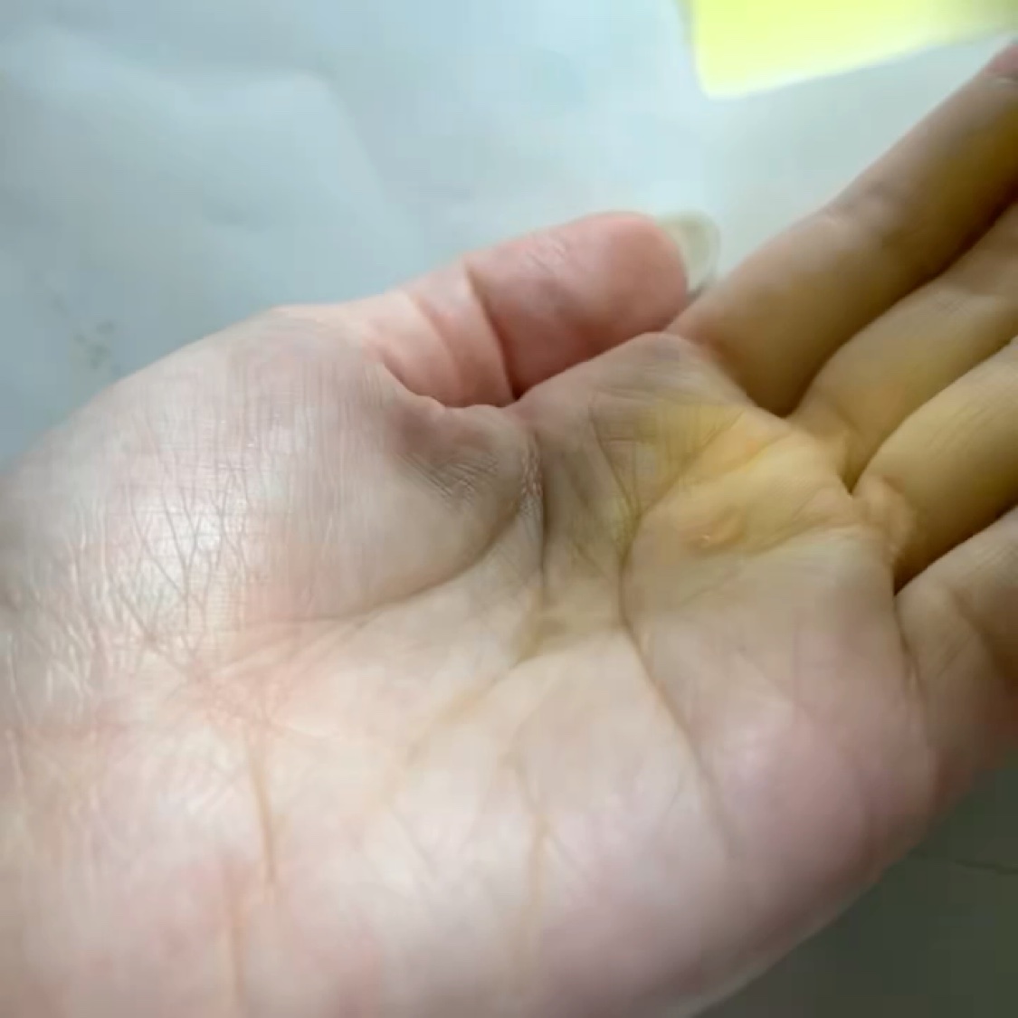 ナイアシンアミドブレミッシュケアセラム/ONE THING/美容液を使ったクチコミ（2枚目）