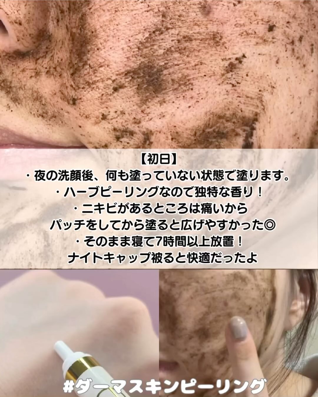 ダーマスキンピーリング/BQCELL/その他キットセットを使ったクチコミ（3枚目）