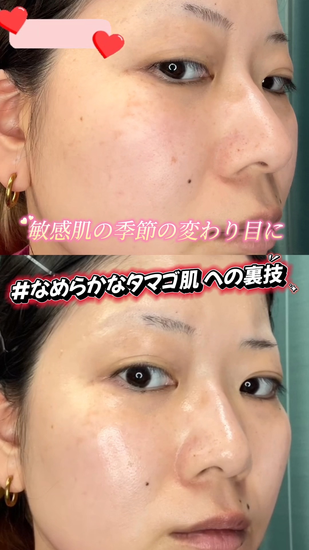 ブラックライスナイトナイトレチノールセラム/haruharu wonder/美容液を使ったクチコミ（1枚目）