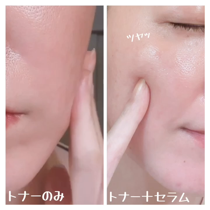 復活草ビフィダセラムファーミングドロップ/Abib /美容液を使ったクチコミ（2枚目）