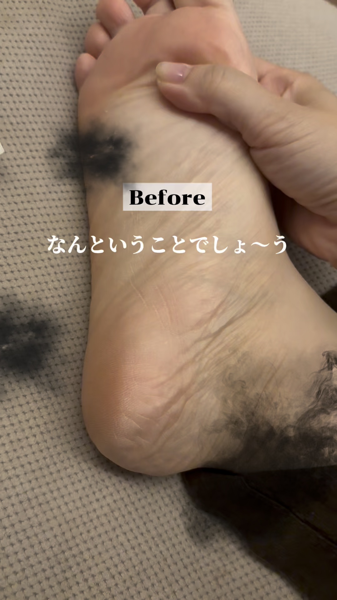 メディカルクリームG（薬用クリームG）/メンターム/ハンドクリームの動画クチコミ3つ目