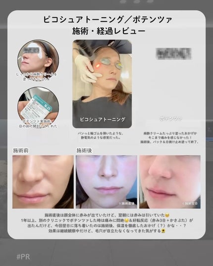 を使ったクチコミ(3枚目)