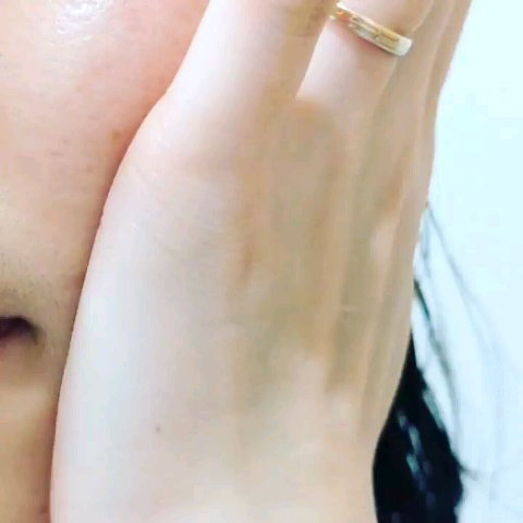 REJURAN ターンオーバーアンプル 30ml/REJURAN COSMETICS/美容液を使ったクチコミ（3枚目）