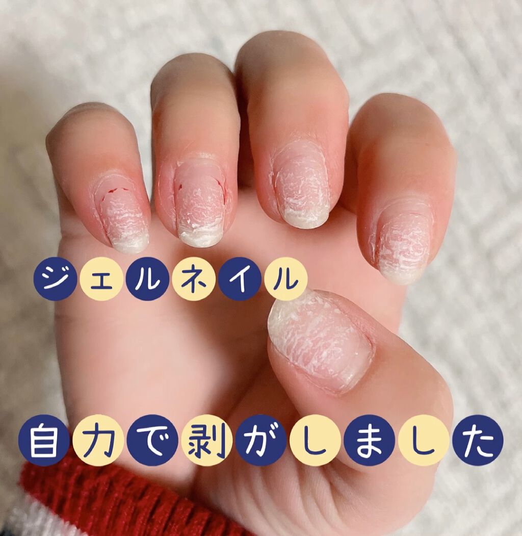 ネイルポリッシュリムーバー EX/D-UP/除光液を使ったクチコミ（1枚目）