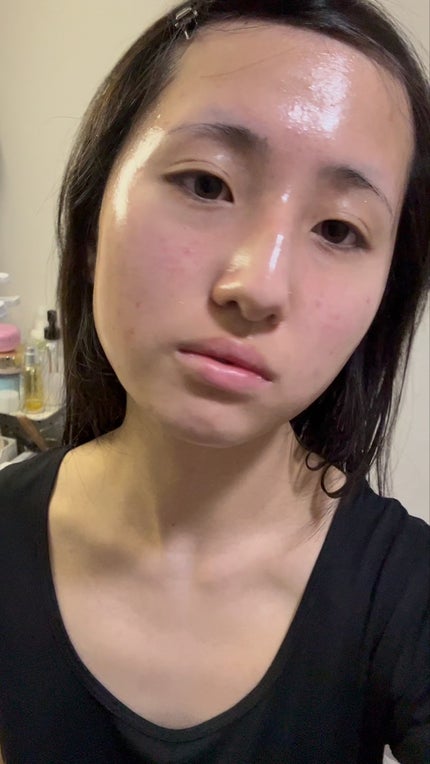 フレッシュピールオフパック プラスピンク/ももぷり/ピーリングを使ったクチコミ(2枚目)