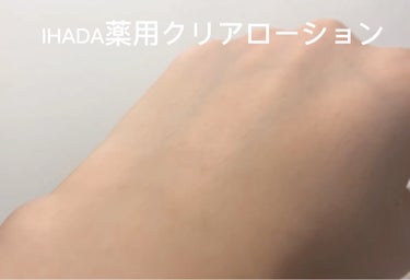 IHADA 薬用クリアローションのクチコミ「敏感肌さんにオススメ！
ドラッグストアで買える化粧水
✼••┈┈••✼••┈┈••✼••┈┈•.....」（1枚目）