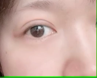 二重整形の画像 動画一覧 Lips