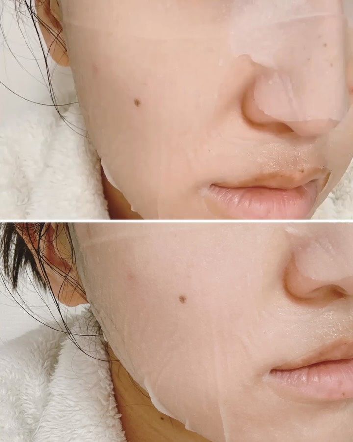 H9 ヒアルロニック アンプルマスク/JMsolution/シートマスク・パックを使ったクチコミ（2枚目）