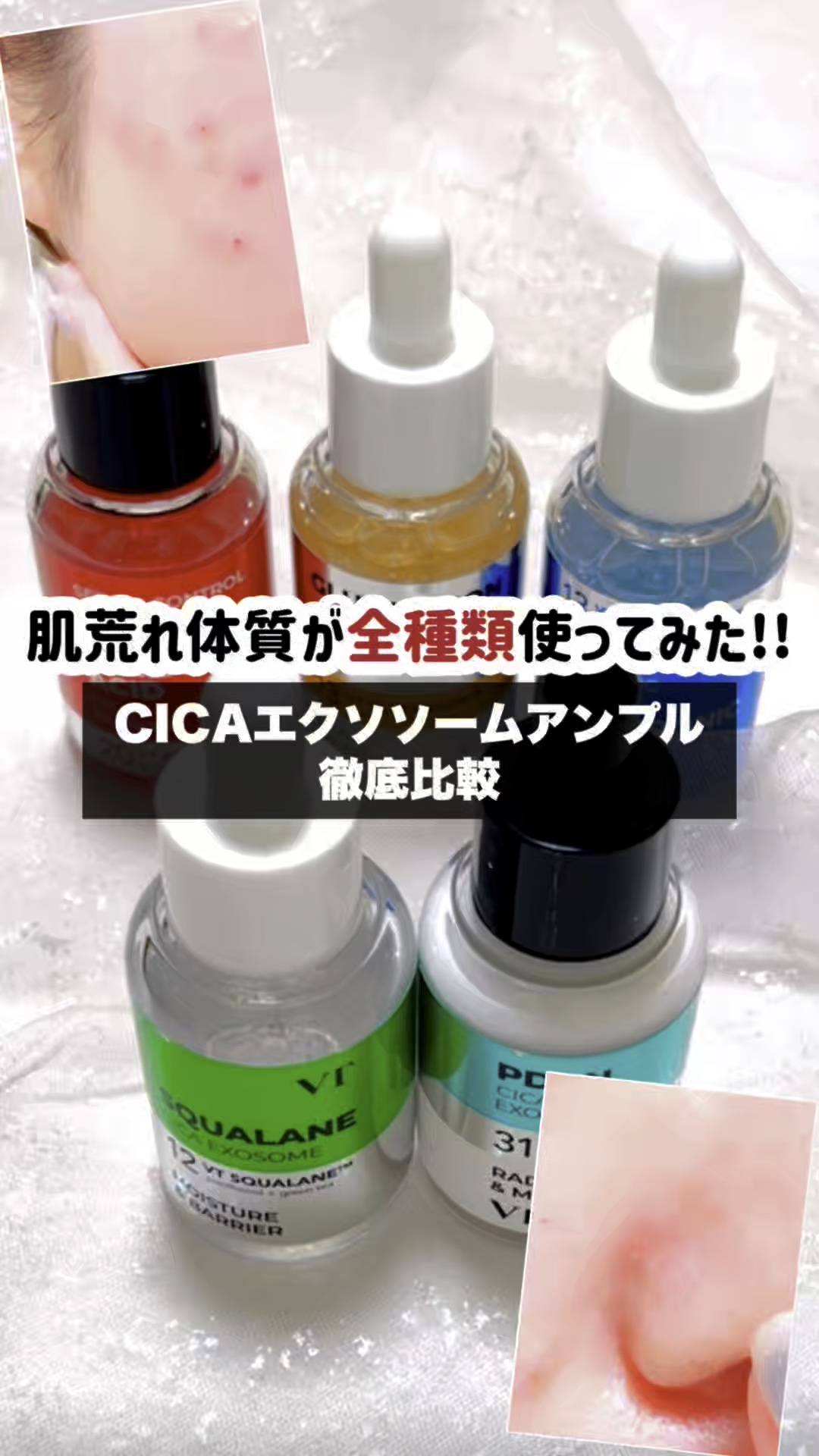 R5ファーミング アンプル/VT/美容液の人気ショート動画