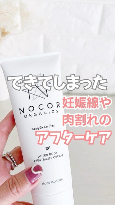 NOCOR ノコア♡アフターボディトリートメントクリーム 肉割れ 妊娠線クリーム