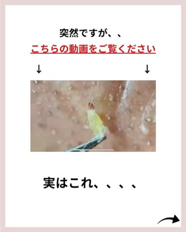 あなたの肌に合ったスキンケア💐コーくん on LIPS 「【知らないと損】鼻の角栓エグいほど消す裏技🔥..あなたの毛穴の..」（2枚目）