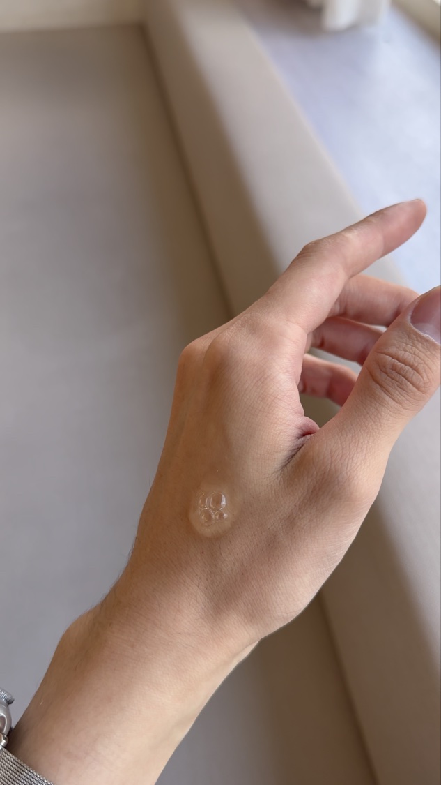 ビタ3セラム/オーズナリー/美容液を使ったクチコミ（2枚目）