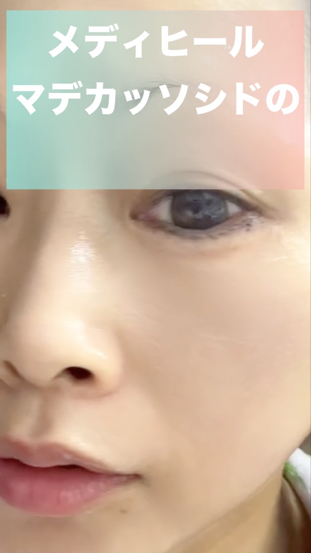 マデカッソシドダーマクリームパッククレンザー	/MEDIHEAL/クレンジングクリームを使ったクチコミ（1枚目）