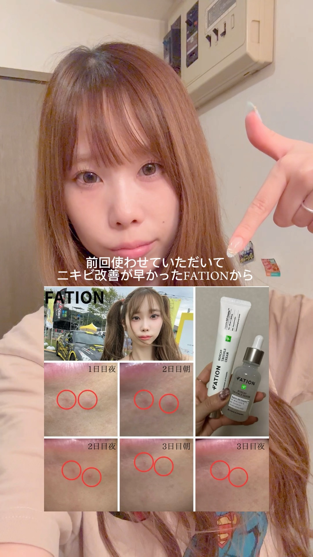 ノスカナイン トラブルセラム マスク/FATION/シートマスク・パックの動画クチコミ1つ目