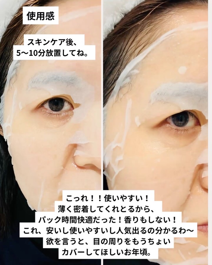 PDRN リフティングマスク/MEDIHEAL/シートマスク・パックを使ったクチコミ（3枚目）