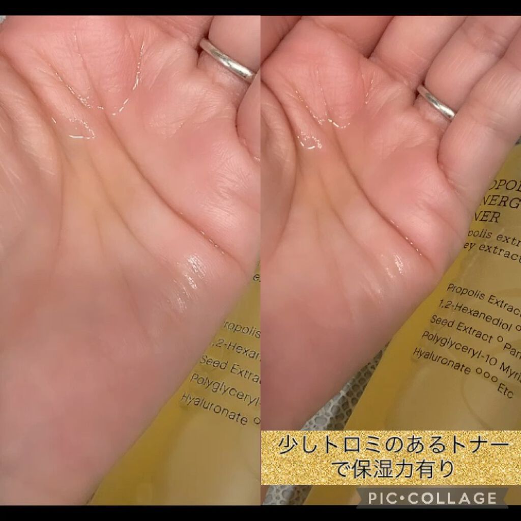 フルフィットプロポリスシナジートナー/COSRX/化粧水を使ったクチコミ（2枚目）